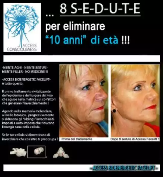 Access_facelift_locandina.jpg